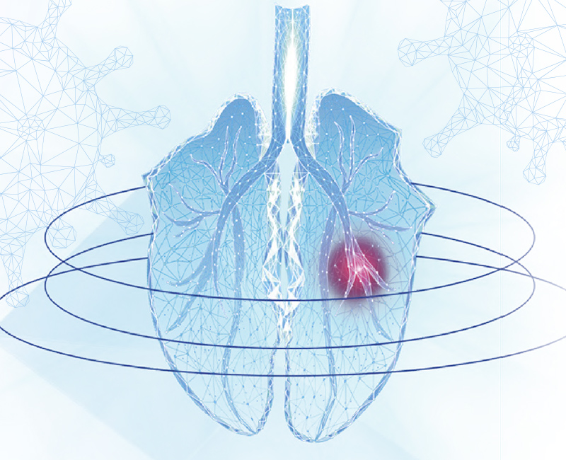El papel de la influenza en el complejo respiratorio de origen multifactorial